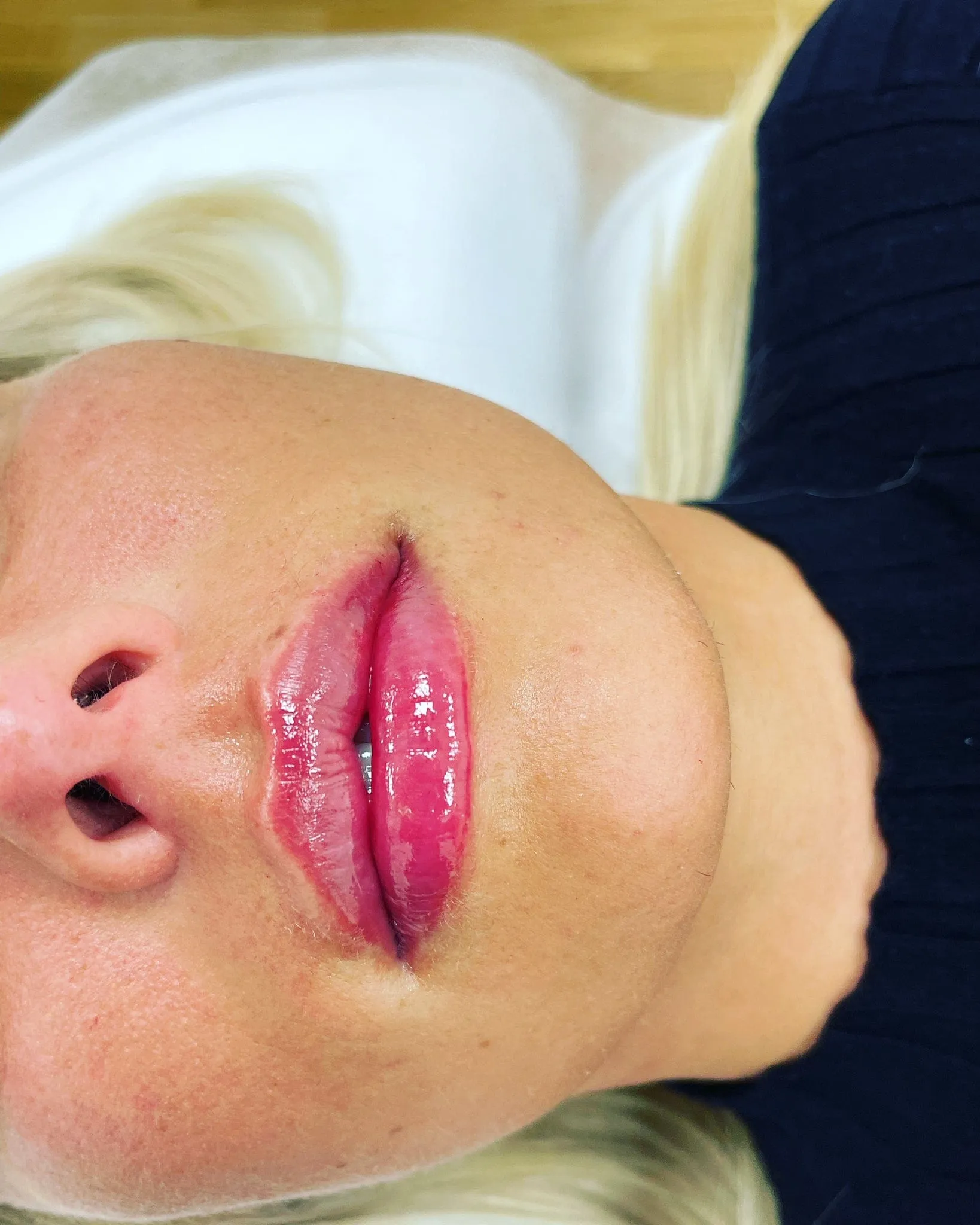 Russian lips - Master läpp filler