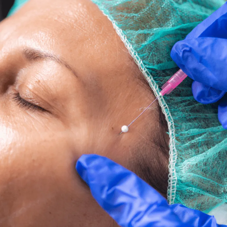 Trådlyft monotrådar